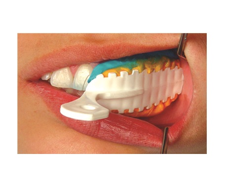 Moldeira Parcial Plastica Moldex Posterior Com 12 Angelus