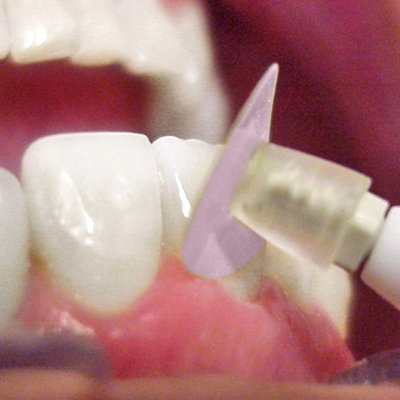 Disco De Lixa Superfix Sort. C-25 Tdv C Mandril